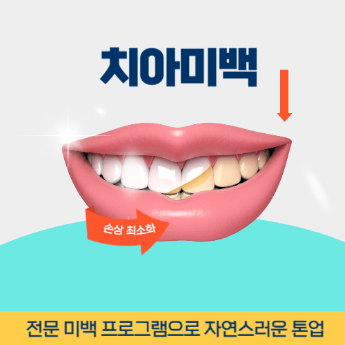 경산치과 경산시 치과 치아미백