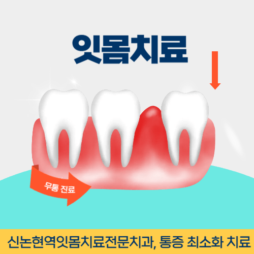 경산치과 경산시 치과 잇몸치료
